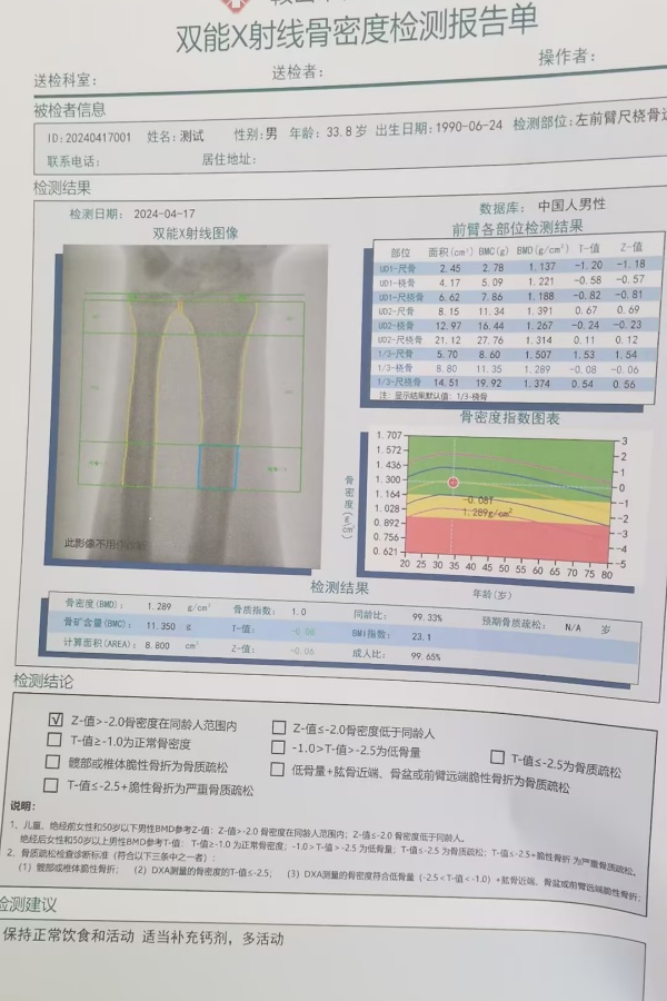 雙能X射線骨密度儀：準(zhǔn)確測量骨密度，助力骨質(zhì)疏松防治，守護骨骼健康